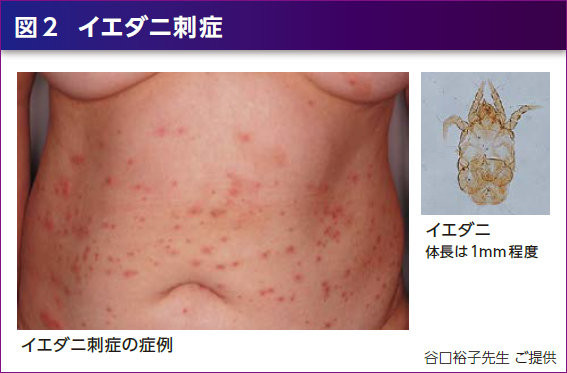 虫刺され高田馬場皮膚科・形成外科