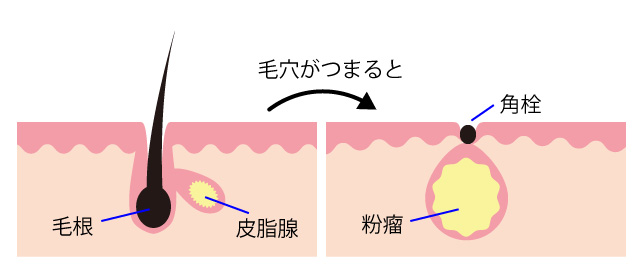 脂肪腫医療法人社団豊正会 大垣中央病院