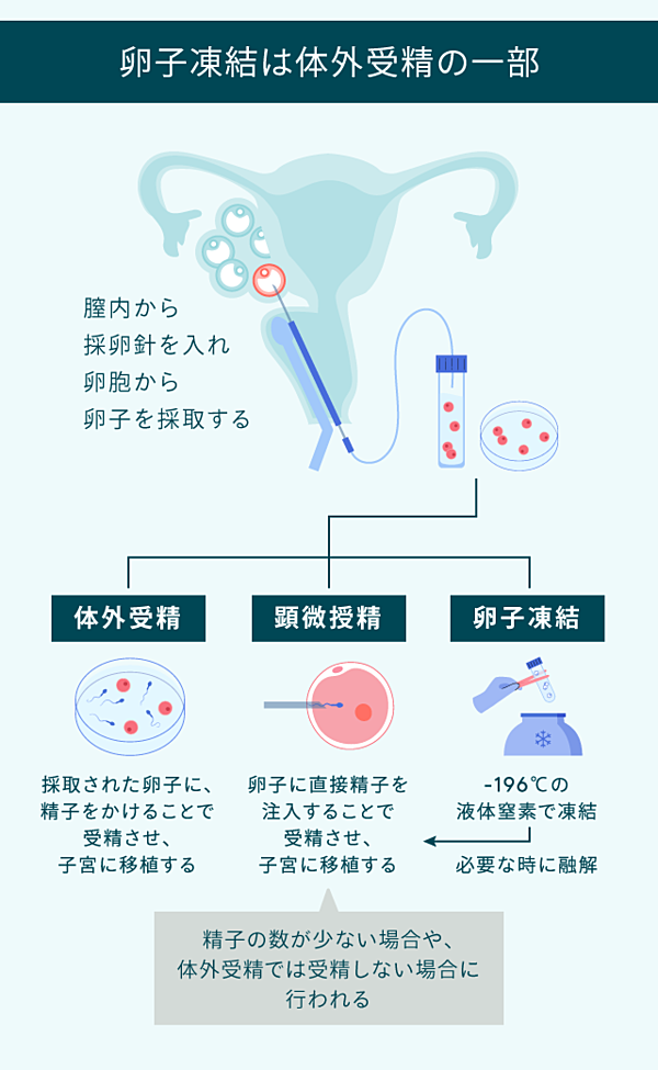 体外受精日吉台レディースクリニック