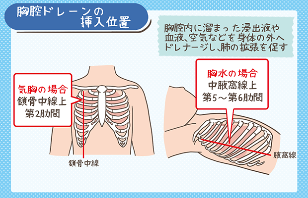 メディテックジャパン 処置キット黄バッグ 胸腔ドレナージ DMAT用ディスポ鉗子セット1セット 黄バッグ 胸腔ドレナージ1セット ご注文単位1セット直送品包装用品・店舗用品の通販 シモジマ