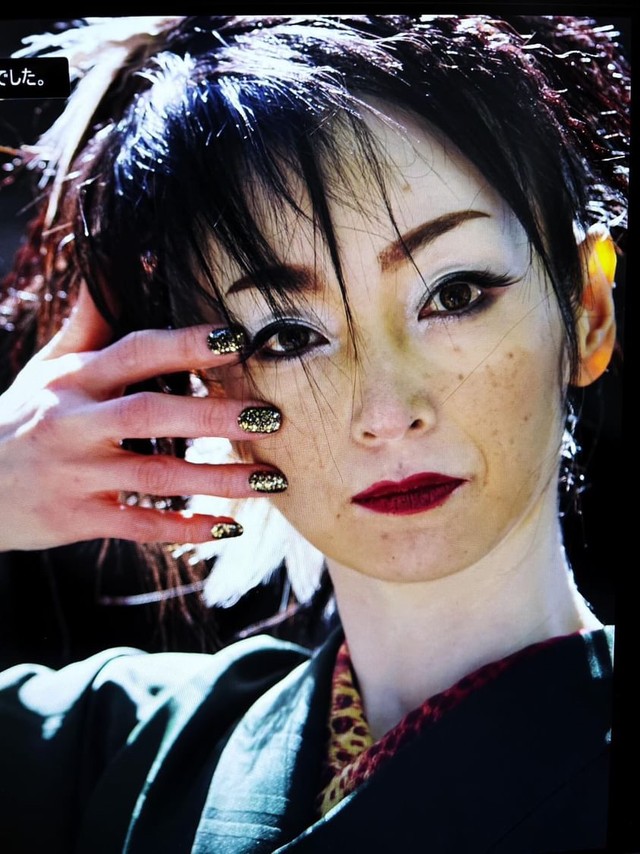 尋常性白斑の症状と原因、治療海老名皮フ科クリニック