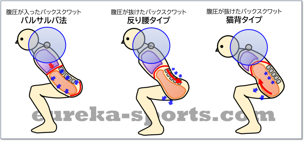 スクワットの腰が痛い問題について木下 進人