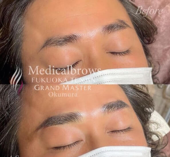 森岡メディカルブロー福岡天神院眉アート・アートメイクのArt+