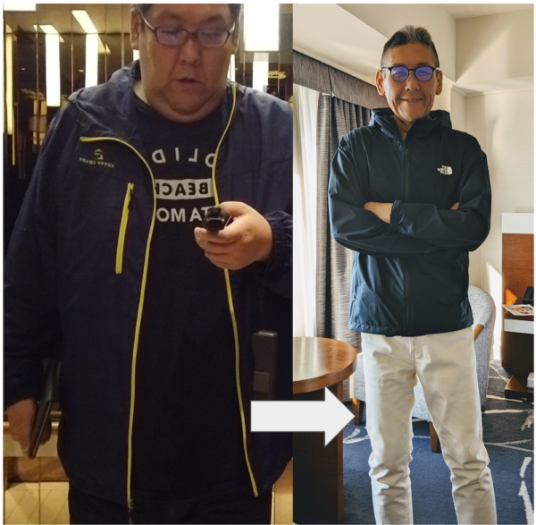 メンズ痩身エステについての調査 20~60代男性の体型悩み1位は「お腹周りの脂肪」だった ！株式会社FoRのプレスリリース