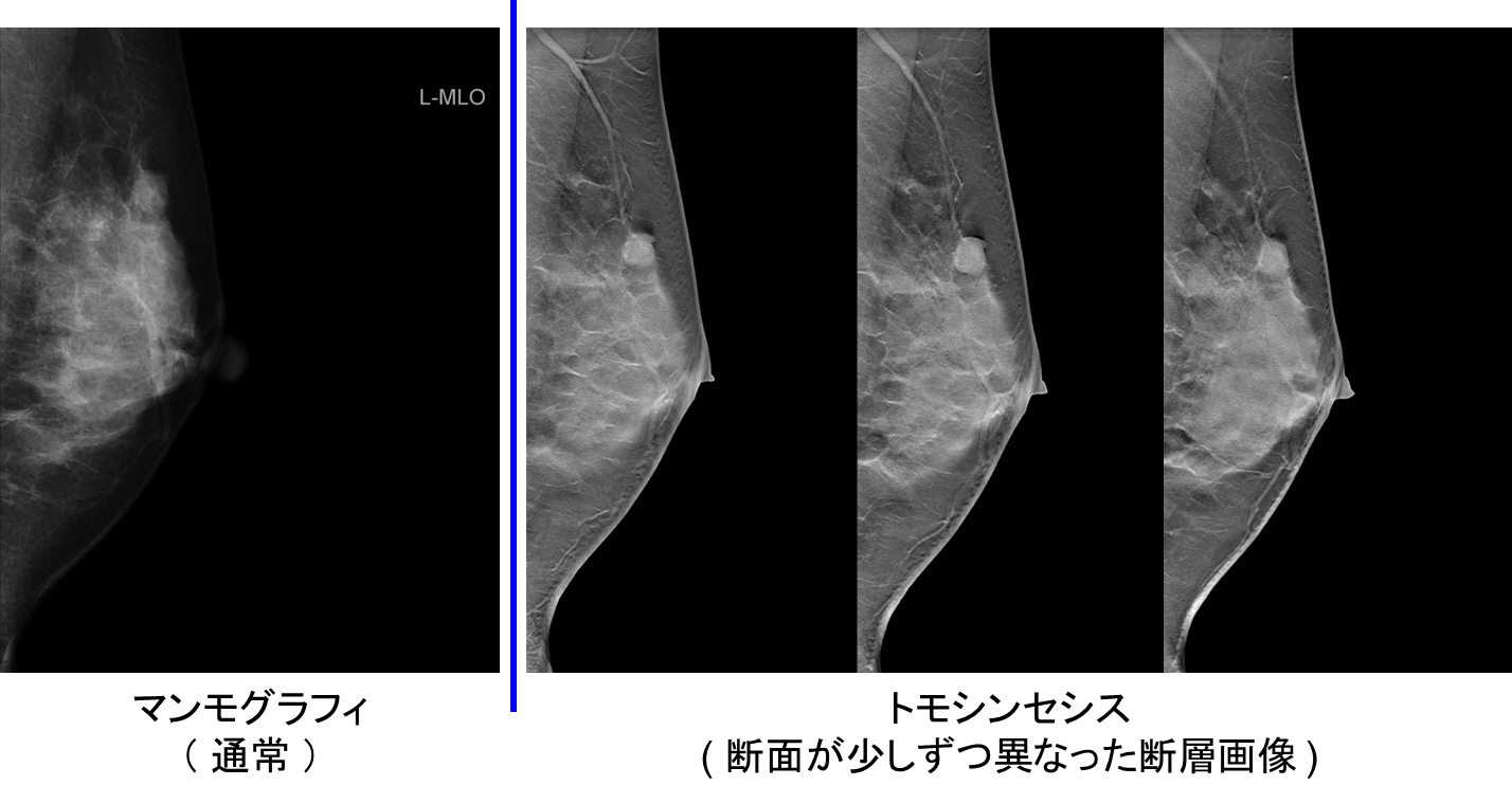 レントゲン撮影とは？放射線診断科鎌ケ谷総合病院