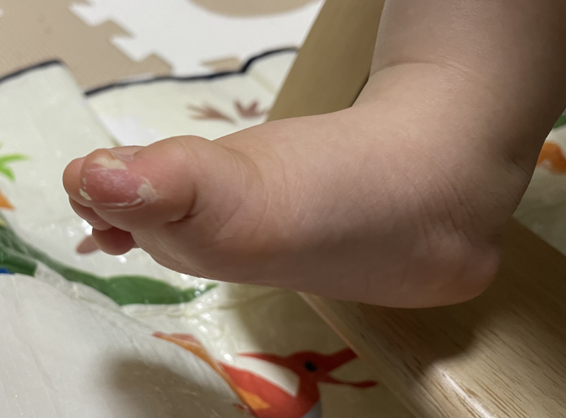 新生児落屑の新着記事アメーバブログ アメブロ