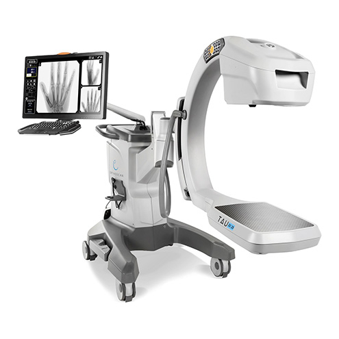 外科用X線TVシステム OPESCOPE ACTENO™ : 株式会社島津製作所