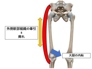 太ももの付け根が痛い原因4つ疾患や対策についても解説