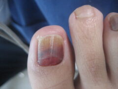 院長ブログ・整形外科コラムJR川西池田駅近の医療法人社団浜田整形外科