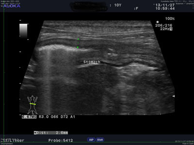 第２章 超音波セミナ