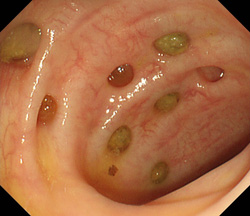 宿便の出し方とは？食べ物やサプリで滞留便を出す方法 専門家コメント付