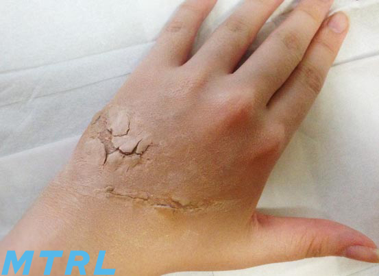 ティッシュで傷メイク - YouTube