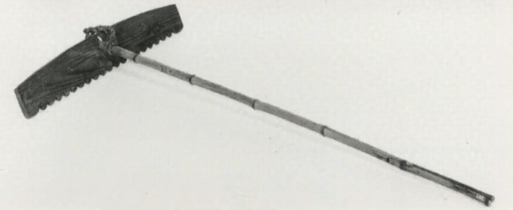 脳動脈瘤コイル塞栓術流山中央病院 脳神経外科ページ