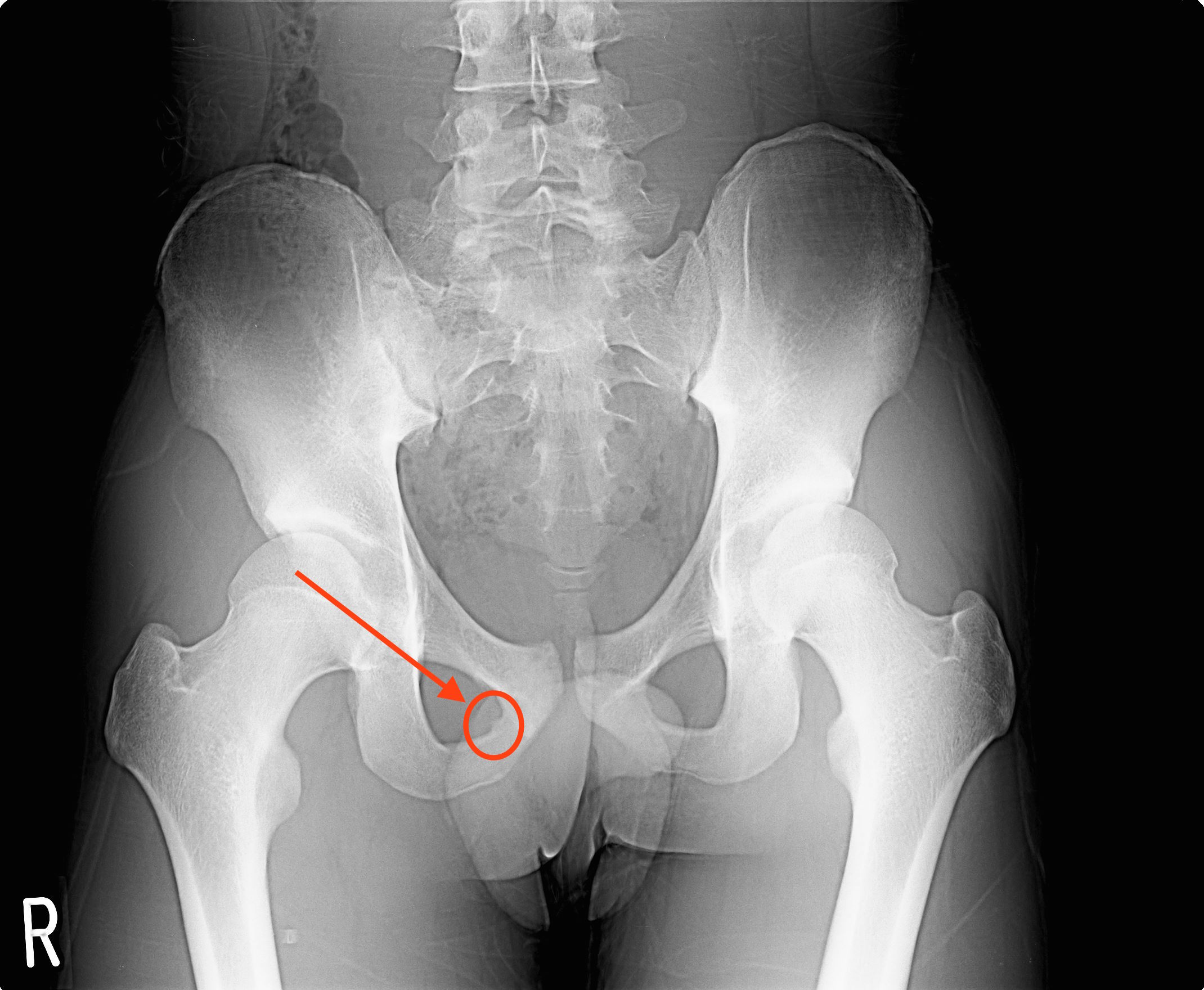 大腿骨頭壊死たかや動物病院京都府亀岡市の動物病院