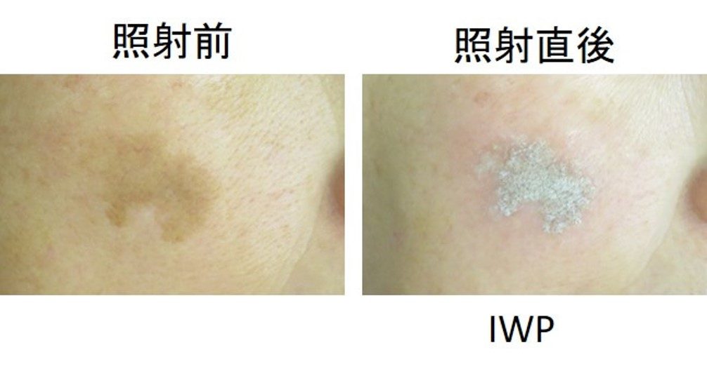 シミ取り放題 シミ治療みかこクリニック -Mikako Clinic- 形成外科 美容外科 美容皮膚科 一宮駅東口徒歩１分