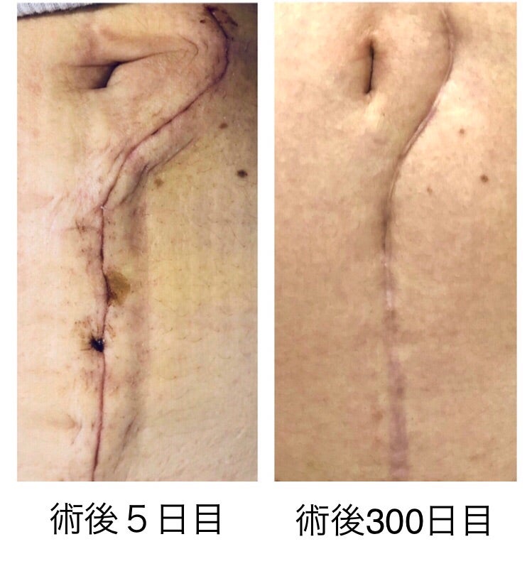 腹腔鏡手術東京慈恵会医科大学 産婦人科学講座