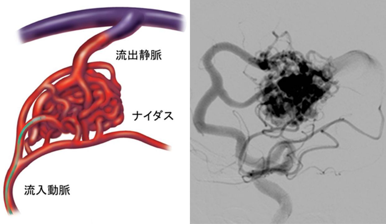 エンボリ 文化遺産オンライン