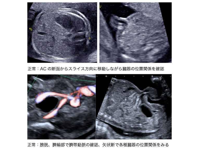 妹の妊娠、ときどき私。～4話 エコー写真の見方がわからない！～ - 生理のことから妊娠・出産・育児まで。女性のための情報サイト ルナルナ生理のことから 妊娠・出産・育児まで。女性のための情報サイト ルナルナ
