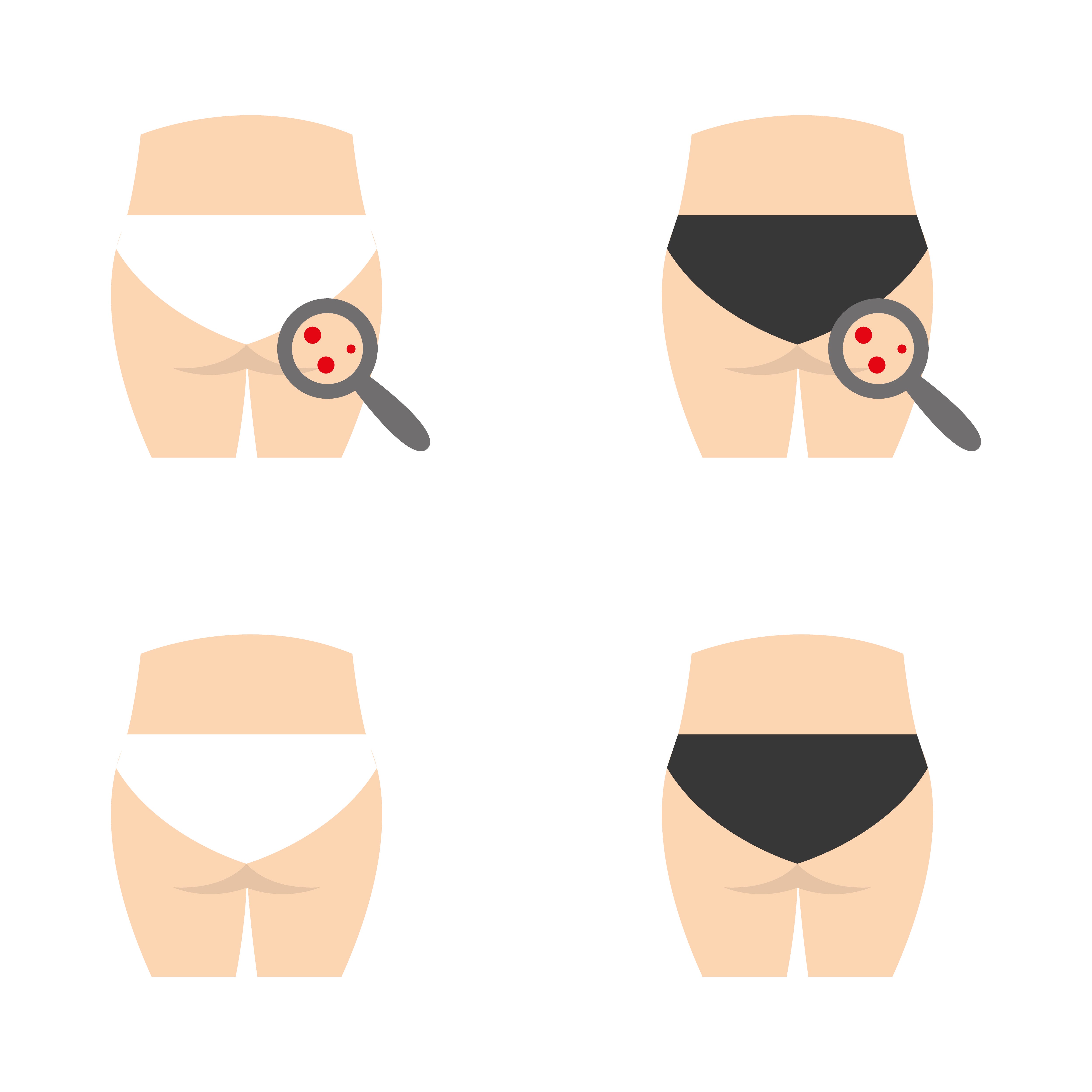 Amazonお尻のブツブツに！医薬部外品 お尻 ブツブツ 黒ずみ 美尻 お尻ケア お尻ニキビ ツルツル 魅惑のおしり プレミアム クリーム おしりザラつき 50g1ナチュレ ブラン NATURA BLANCボディクリーム 通販