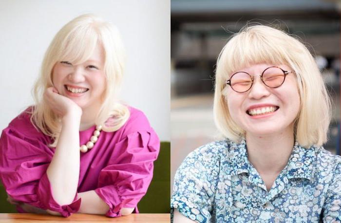 尋常性白斑 じんじょうせいはくはん- 板橋区成増駅前かわい皮膚科