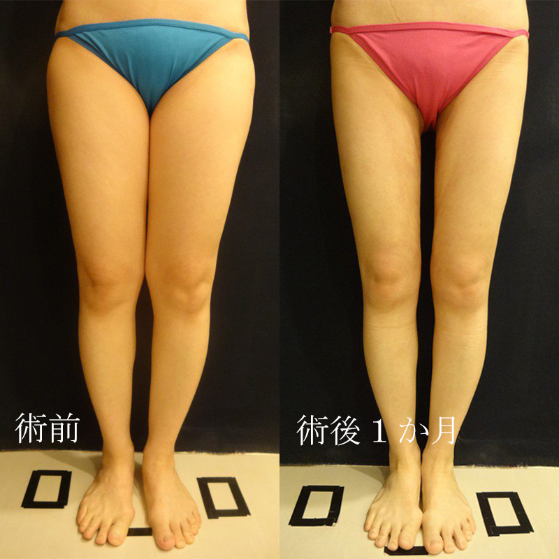 太もも裏ストレッチ：今日の1ポーズストレッチ：日経Gooday グッデイ