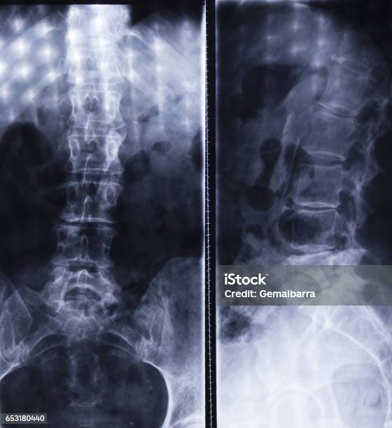 マックディー McDee on X: 