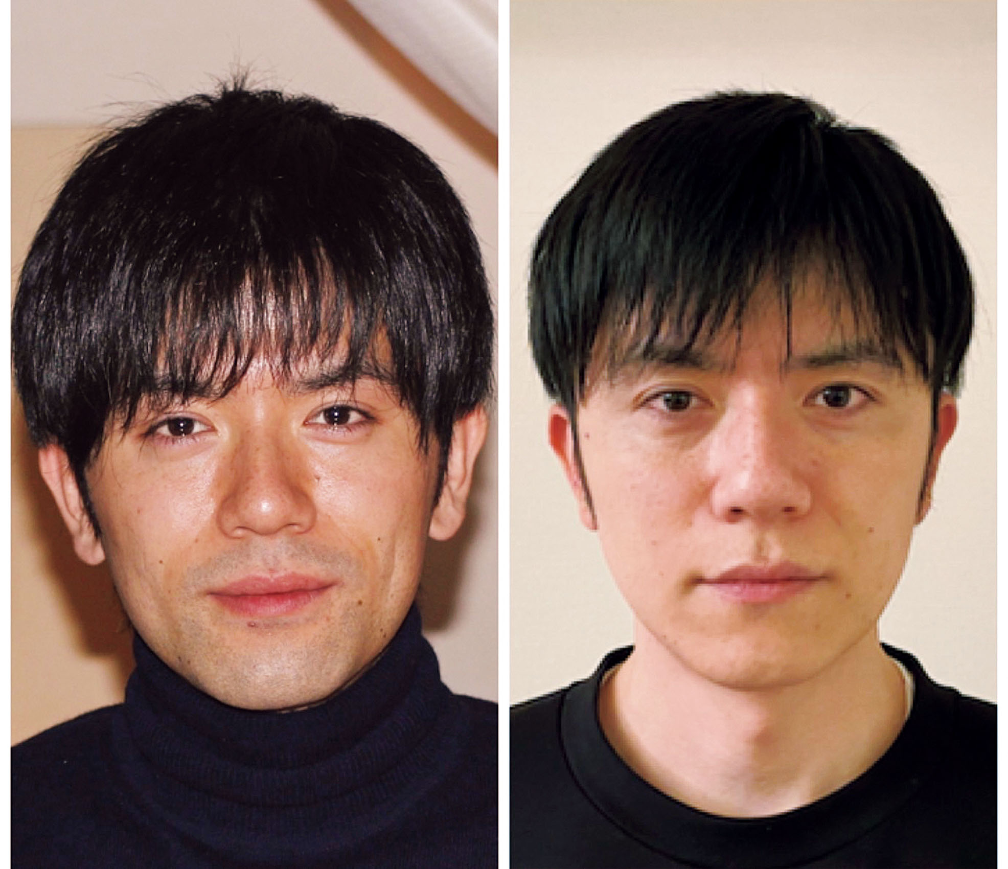 注意点は？ 女性の口まわりの「ひげ・うぶ毛」対策５選美的.com