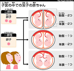 双胎イラスト無料イラスト・フリー素材なら「イラストAC」
