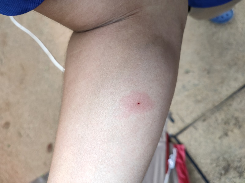 アブが発生する原因とは？アブの退治方法と予防対策 - For your LIFE