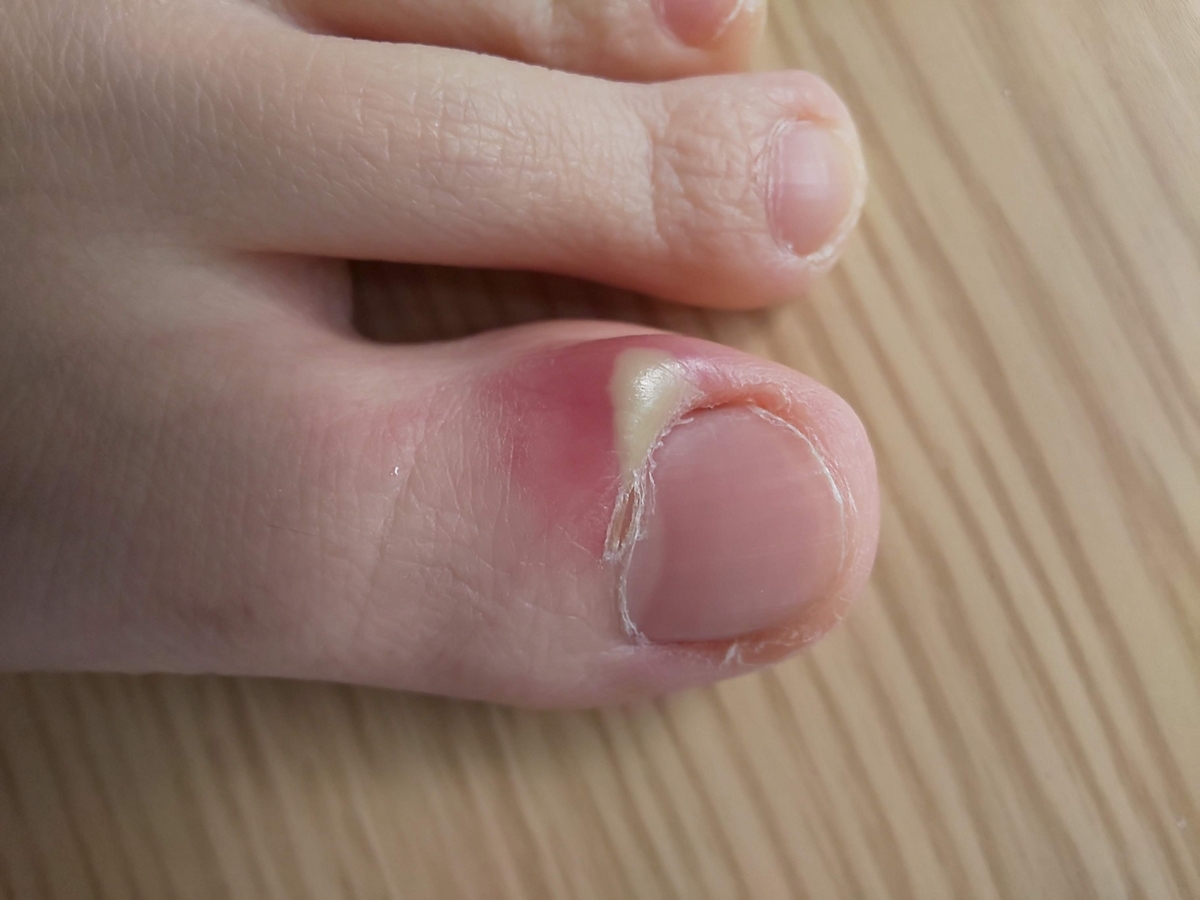 免疫について考えてみよう＜３＞