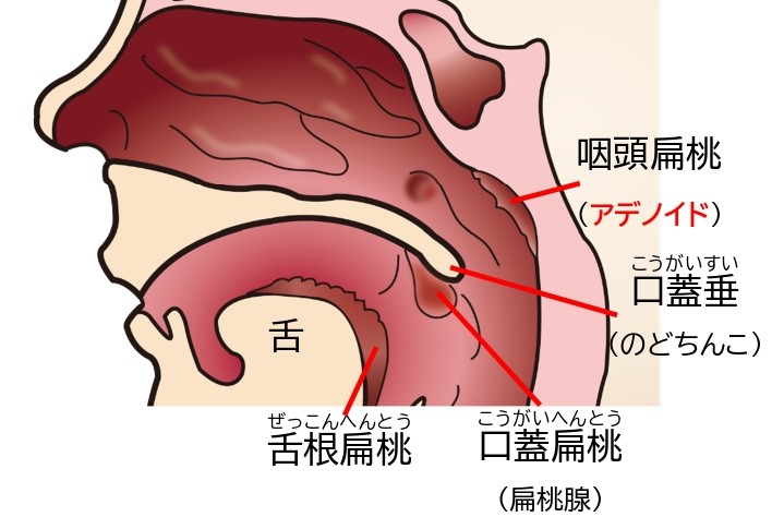 睡眠時無呼吸、小児に広がる 扁桃腺など肥大化で気道狭まる 落ち着きなく粗暴に - 日本経済新聞
