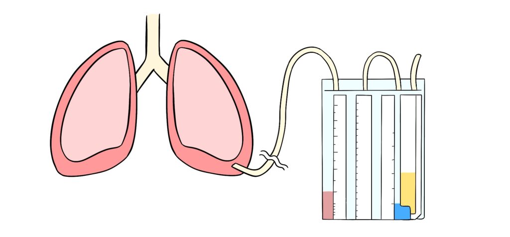 手術・ドレナージSBカワスミ株式会社