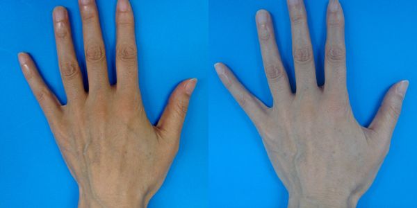 指を綺麗に見せる方法2024 年のリアルなLemon8ユーザー体験