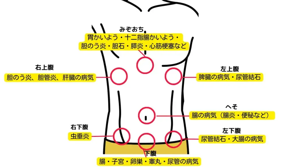 マラソンの腹痛「差し込み」、腸内のガスや肝臓の揺れが誘因 対策は - 日本経済新聞