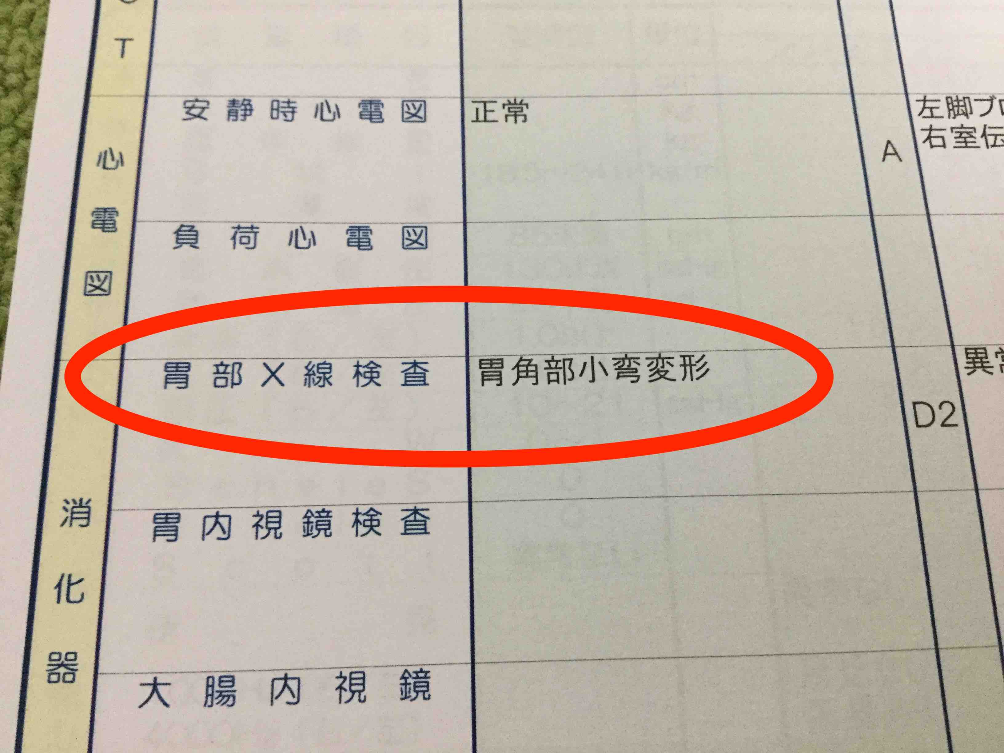 消化管造影検査 バリウム と内視鏡検査の違いは何ですか？日本消化器内視鏡学会