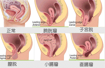 オルガ-ワン≪膣の中とクリをサンド！！気持ちいい所を徹底刺激☆≫