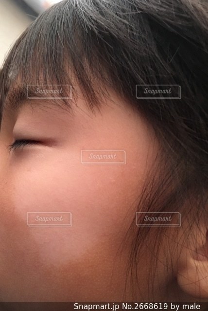 乾燥肌 ドライスキン吹田市の皮膚科もりはら皮ふ科クリニック