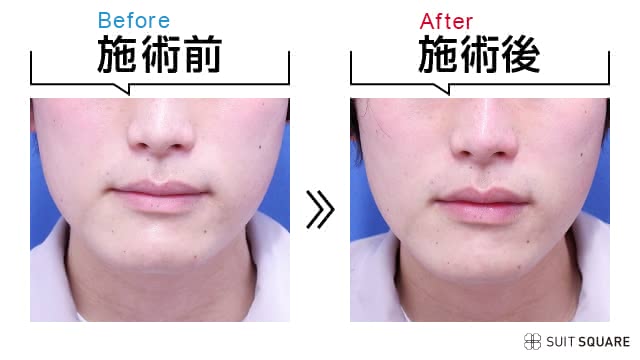 SE ボディウォッシュゴリラコスメティクス