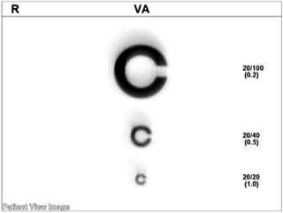 免許取得に必要な視力はいくつ？自動車教習所の視力検査を徹底解説！確実に合格！旭川の教習所の選び方ガイド