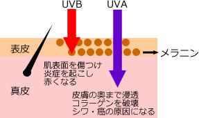 日焼け後の悩み！ 水ぶくれを安全に治す方法とは