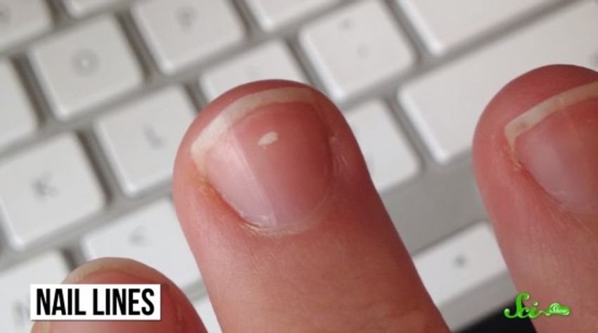 国立市での爪の病気谷保駅前皮フ科