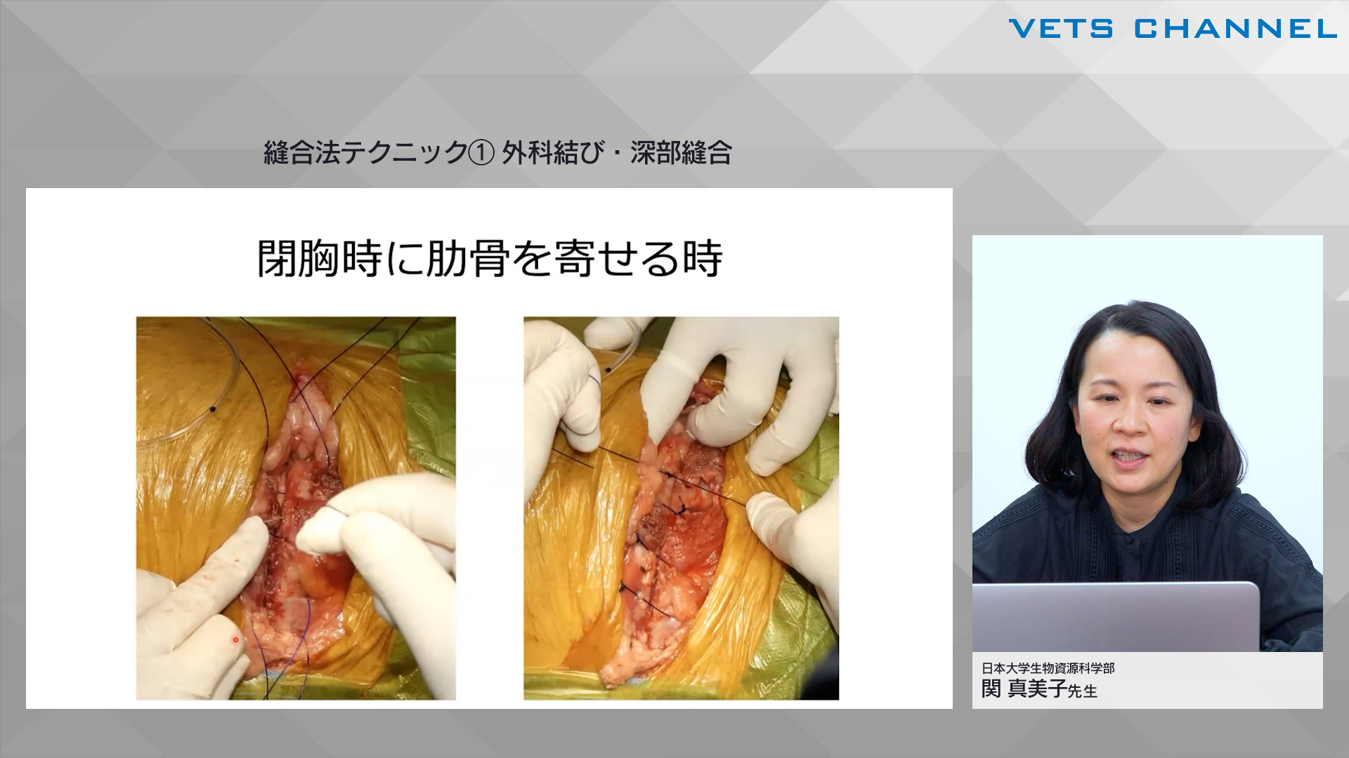 皮膚縫合 縫合結紮手技 単結節 ・抜糸の基本動作を解説！ 医学生・研修医