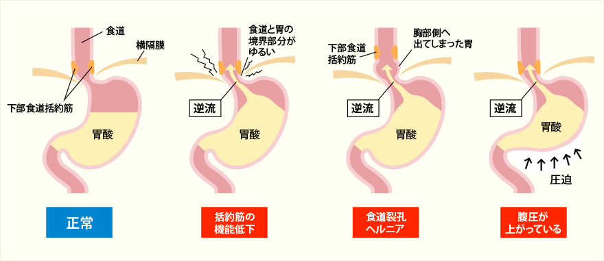 内視鏡医師の知識シリーズ - 福岡の苦しくない内視鏡専門医療機関福岡天神内視鏡クリニック消化器福岡博多院