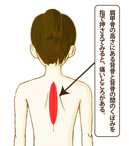 ツボ押し 背中 背筋 伸ばし 首 肩甲骨 刺激 マッサージ 腰痛 肩こり お尻 コリ 筋肉 ほぐす 伸ばす 指圧 疲れ 疲労 解消 ストレッチ 器具スッキリングフィット : lifeone Yahoo!店 - 通販 - Yahoo!ショッピング