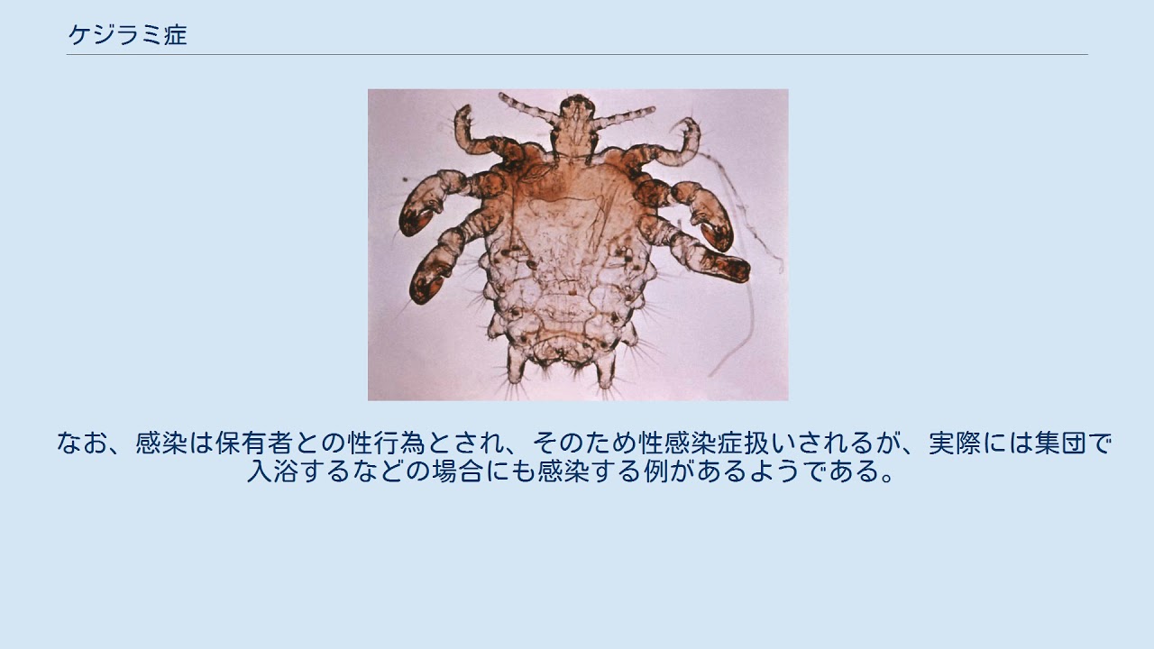 シラミ症こばとも皮膚科栄駅 名古屋市栄区 徒歩2分