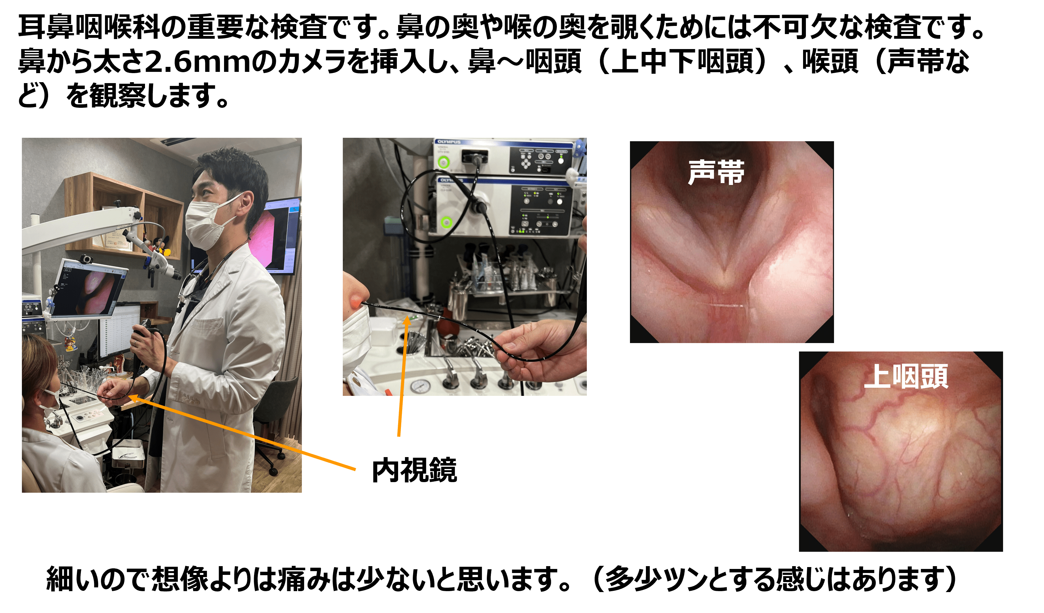 内視鏡検査について費用やわかることを解説池袋ながとも耳鼻咽喉科