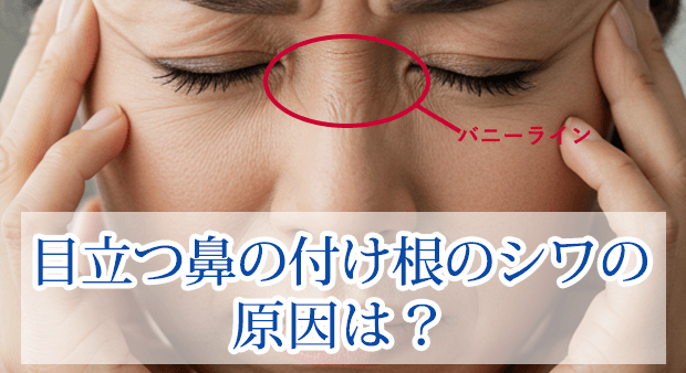 鼻根部のシワを改善したいシワ取りボトックスシワ取り ボトックスの症例写真・画像美容整形のことなら千葉船橋・銀座の東京形成美容外科・美容皮膚科