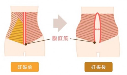 産後のお腹のたるみいつ戻る？引き締めるには ？ダイエット方法を教えて！kosodate LIFE 子育てライフ