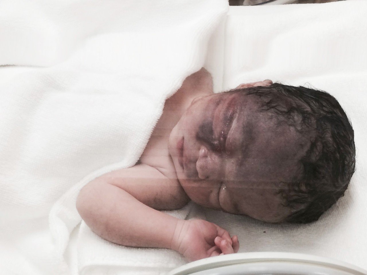 満面の笑みで万歳！ 産まれた瞬間の赤ちゃんの顔が喜びに溢れている