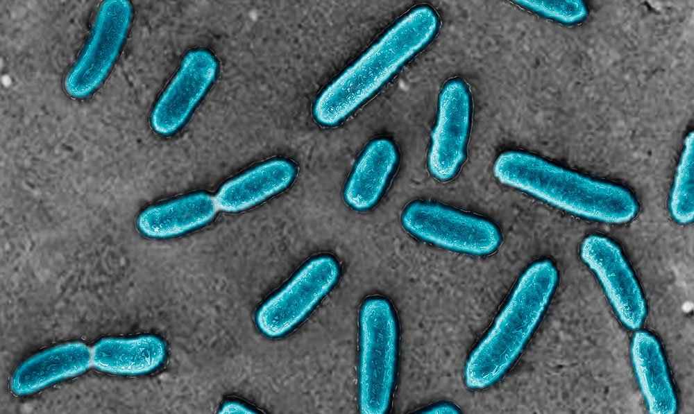 緑膿菌」の写真素材12,552件の無料イラスト画像Adobe Stock